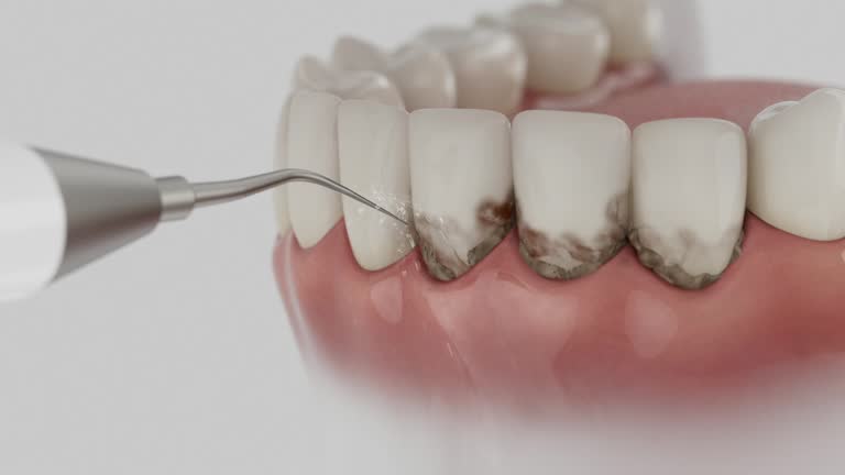 Trusted Root Canal Treatment service in Long Creek, IL - Dentist Open Now